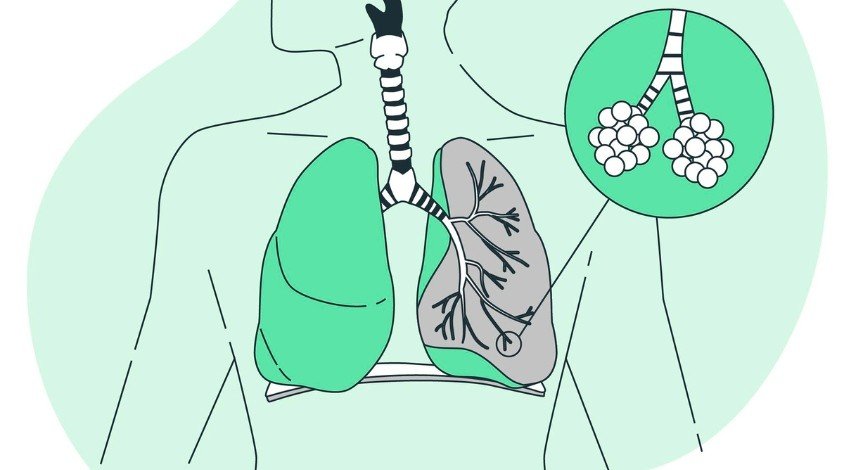 doencas-respiratorias-blog